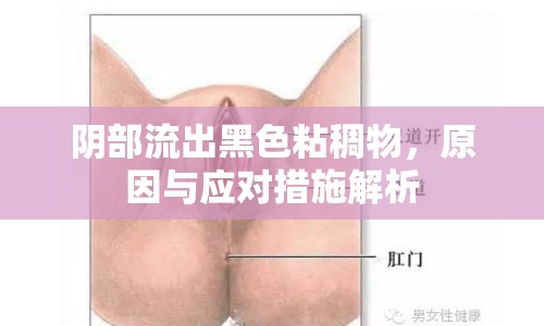 陰部流出黑色粘稠物，原因與應(yīng)對(duì)措施解析