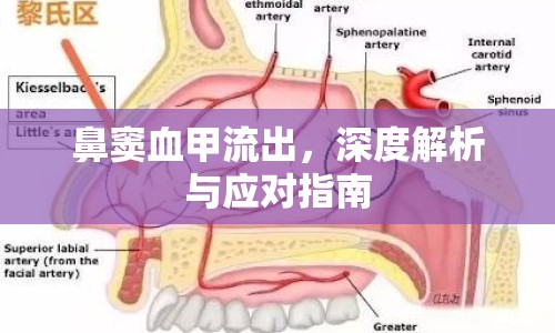 鼻竇血甲流出，深度解析與應(yīng)對(duì)指南