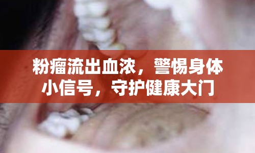 粉瘤流出血濃，警惕身體小信號，守護(hù)健康大門