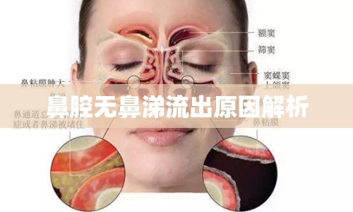 鼻腔無(wú)鼻涕流出原因解析