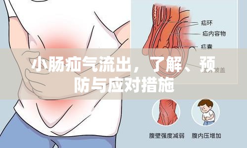小腸疝氣流出，了解、預(yù)防與應(yīng)對措施