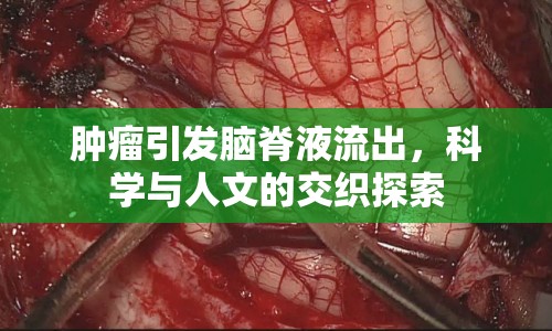 腫瘤引發(fā)腦脊液流出，科學(xué)與人文的交織探索