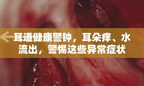 耳道健康警鐘，耳朵癢、水流出，警惕這些異常癥狀！