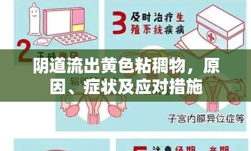 陰道流出黃色粘稠物，原因、癥狀及應(yīng)對措施