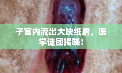子宮內(nèi)流出大塊紙屑，醫(yī)學(xué)謎團(tuán)揭曉！