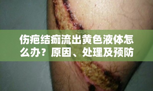 傷疤結(jié)痂流出黃色液體怎么辦？原因、處理及預(yù)防措施全解析