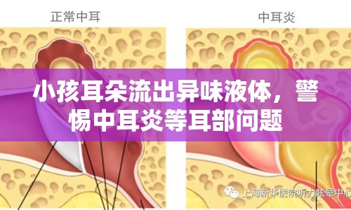 小孩耳朵流出異味液體，警惕中耳炎等耳部問題