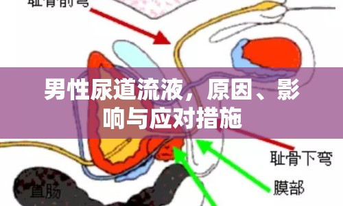 男性尿道流液，原因、影響與應(yīng)對(duì)措施