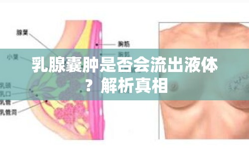 乳腺囊腫是否會流出液體？解析真相