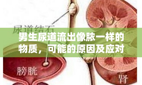 男生尿道流出像膿一樣的物質(zhì)，可能的原因及應(yīng)對措施