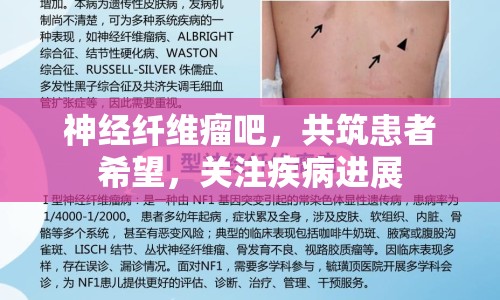 神經纖維瘤吧，共筑患者希望，關注疾病進展