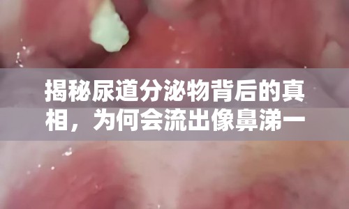 揭秘尿道分泌物背后的真相，為何會(huì)流出像鼻涕一樣的東西？