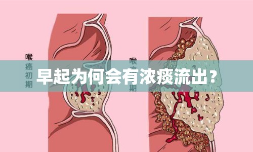 早起為何會有濃痰流出？