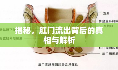 揭秘，肛門流出背后的真相與解析