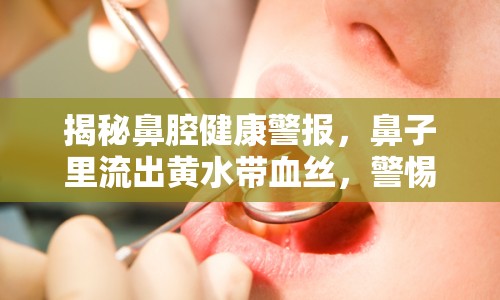 揭秘鼻腔健康警報，鼻子里流出黃水帶血絲，警惕這些疾?。? class=