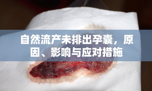 自然流產(chǎn)未排出孕囊，原因、影響與應(yīng)對(duì)措施