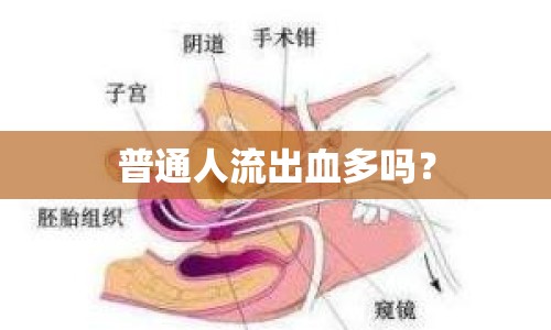 普通人流出血多嗎？