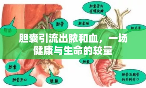 膽囊引流出膿和血，一場健康與生命的較量