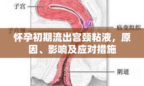 懷孕初期流出宮頸粘液，原因、影響及應(yīng)對措施