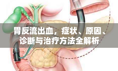 胃反流出血，癥狀、原因、診斷與治療方法全解析