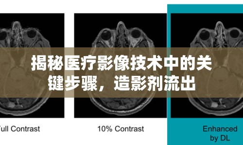 揭秘醫(yī)療影像技術中的關鍵步驟，造影劑流出