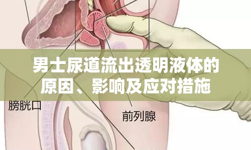 男士尿道流出透明液體的原因、影響及應對措施