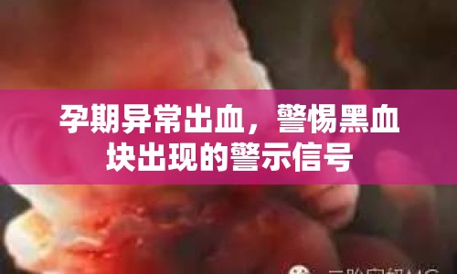 孕期異常出血，警惕黑血塊出現(xiàn)的警示信號(hào)