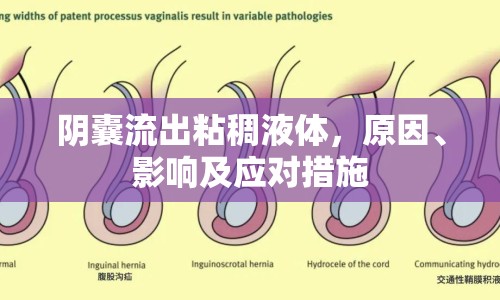 陰囊流出粘稠液體，原因、影響及應(yīng)對(duì)措施