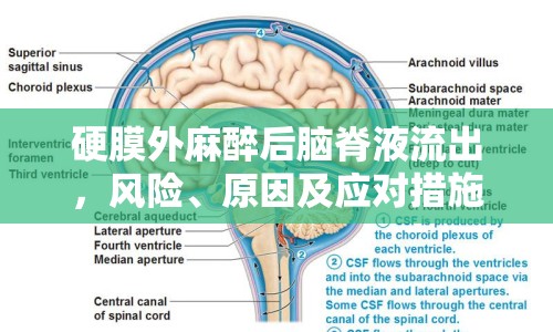 硬膜外麻醉后腦脊液流出，風(fēng)險(xiǎn)、原因及應(yīng)對(duì)措施