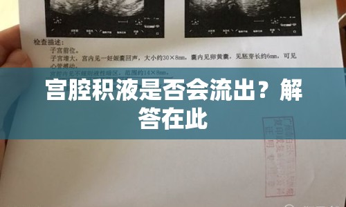 宮腔積液是否會流出？解答在此