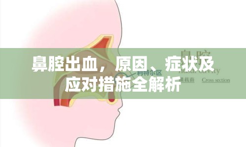 鼻腔出血，原因、癥狀及應(yīng)對(duì)措施全解析
