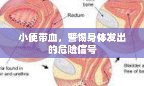 小便帶血，警惕身體發(fā)出的危險(xiǎn)信號(hào)