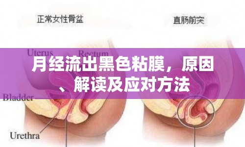 月經(jīng)流出黑色粘膜，原因、解讀及應(yīng)對(duì)方法
