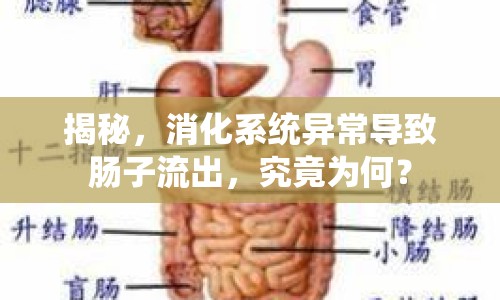 揭秘，消化系統(tǒng)異常導(dǎo)致腸子流出，究竟為何？