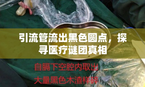 引流管流出黑色圓點(diǎn)，探尋醫(yī)療謎團(tuán)真相