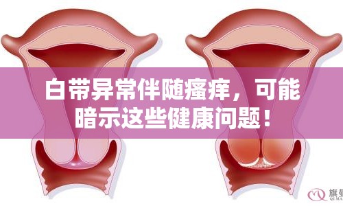 白帶異常伴隨瘙癢，可能暗示這些健康問題！