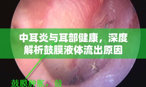 中耳炎與耳部健康，深度解析鼓膜液體流出原因