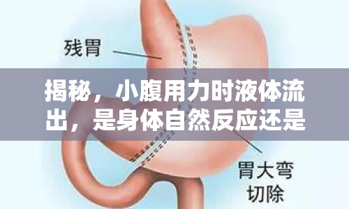 揭秘，小腹用力時(shí)液體流出，是身體自然反應(yīng)還是健康信號(hào)？