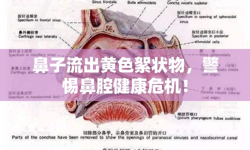 鼻子流出黃色絮狀物，警惕鼻腔健康危機！