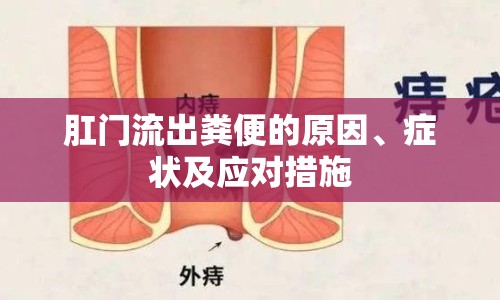 肛門流出糞便的原因、癥狀及應(yīng)對(duì)措施