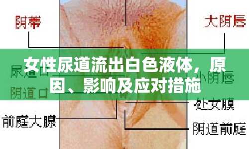 女性尿道流出白色液體，原因、影響及應(yīng)對措施