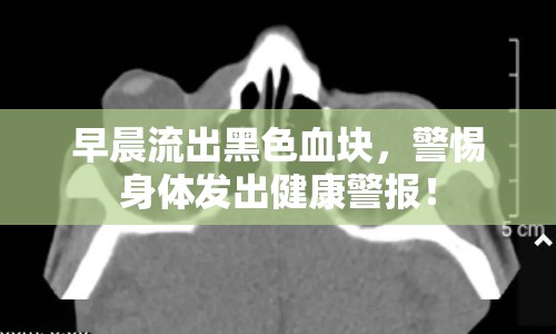 早晨流出黑色血塊，警惕身體發(fā)出健康警報(bào)！