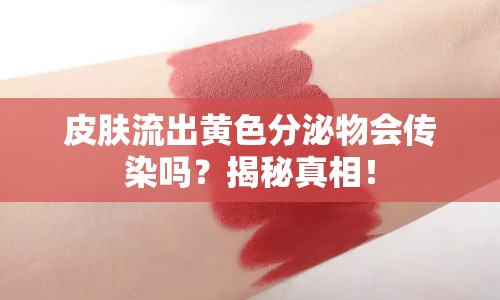 皮膚流出黃色分泌物會傳染嗎？揭秘真相！