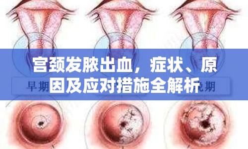 宮頸發(fā)膿出血，癥狀、原因及應對措施全解析