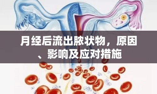 月經(jīng)后流出膿狀物，原因、影響及應(yīng)對措施