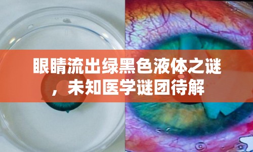 眼睛流出綠黑色液體之謎，未知醫(yī)學謎團待解