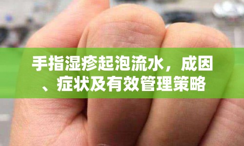 手指濕疹起泡流水，成因、癥狀及有效管理策略