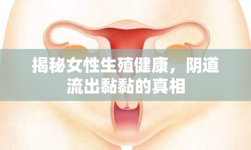 揭秘女性生殖健康，陰道流出黏黏的真相