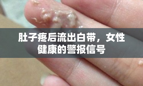 肚子疼后流出白帶，女性健康的警報(bào)信號