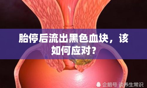 胎停后流出黑色血塊，該如何應(yīng)對(duì)？